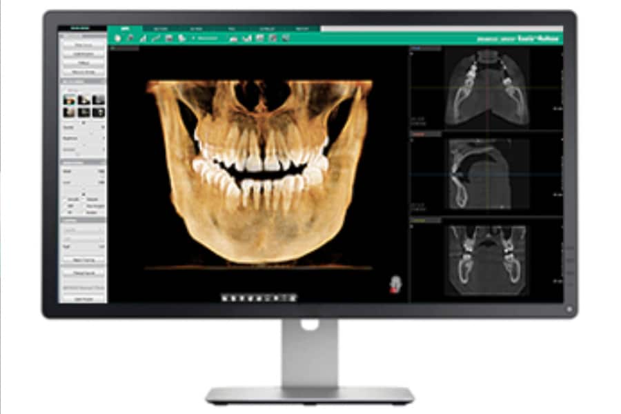 Photo of CBCT imaging