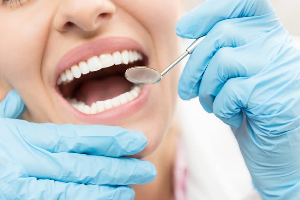 How Full Mouth Reconstruction Can Improve Your Smile and Bite